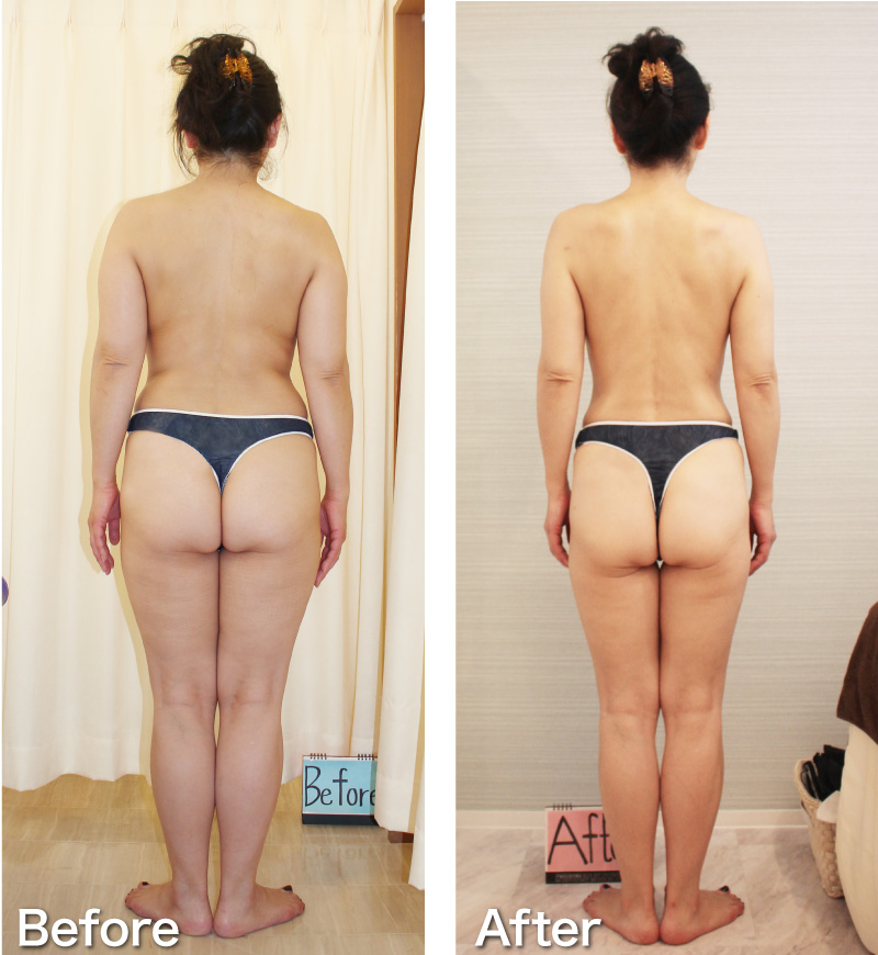 ビフォーアフター 痩身編 大阪の茨木市 高槻市 吹田市の痩身エステやまつ毛パーマならファニービーへ
